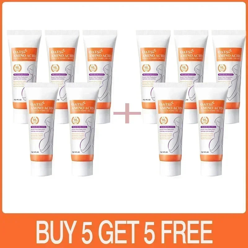 Cream For Pregnancy Stretch Marks Removal Eliminate Red White Old Stretch Marks 26