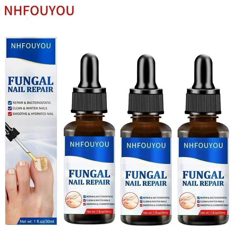 Nail Fungus Treatment  Serum Toe  Fungal Repair Products  Hand Foot Care  Removal Gel Anti Infection Paronychia Onychomycosis